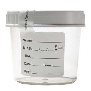 Biodegradable Specimen Container with Screw Cap
